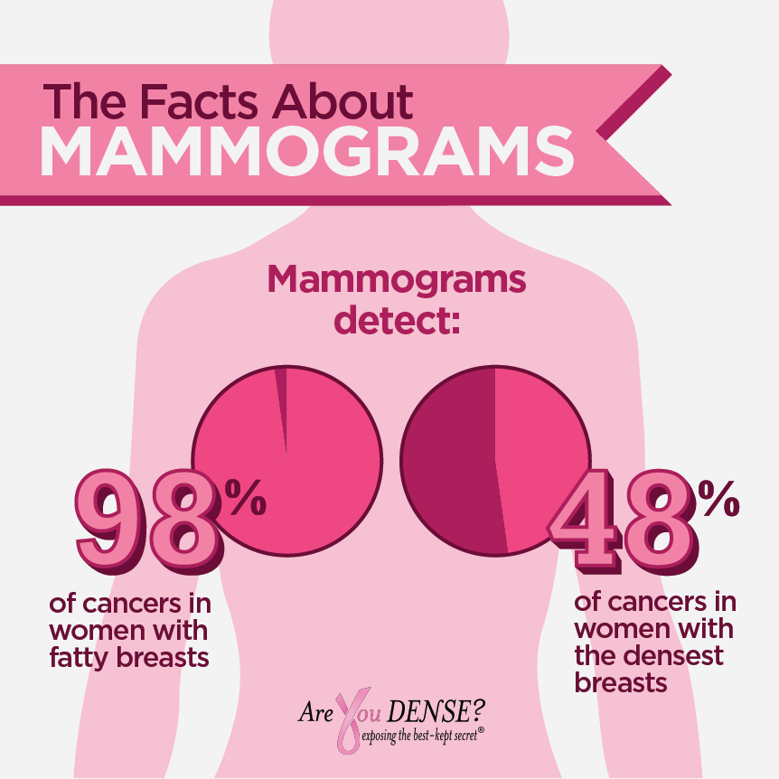 The facts about mammograms: they detect 98% of cancers in fatty breasts but only 48% in the densest breasts