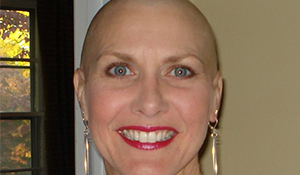 Lynne, bald from treatment, smiling